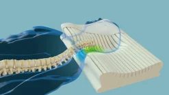 Hot Nackenstützkissen NECKPROTECT Nackenstützkissen|Kissen